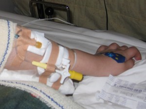 Allemaal slangetjes aan de arm