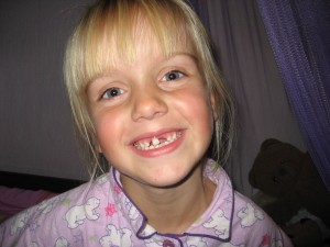 De eerste voortand is eruit